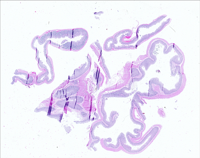 TPU2